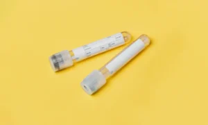 Breast Cancer Salivary Testing