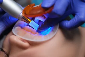 Clinical Use and Operator Impressions with Hard Tissue Laser